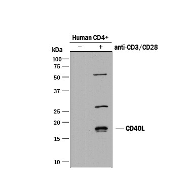 Detection of Human CD40 Ligand/TNFSF5 antibody by Western Blot.