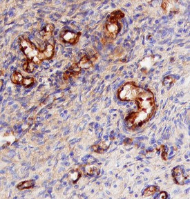 CD47 antibody in Human Placenta by Immunohistochemistry (IHC-P).