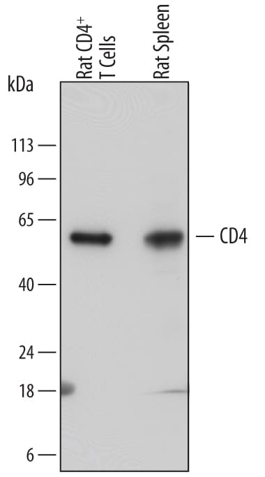 Detection of Rat CD4 antibody by Western Blot.
