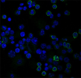 CD4 antibody in Mouse Splenocytes by Immunocytochemistry (ICC).