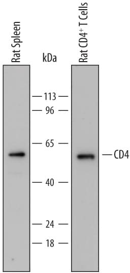 Detection of Rat CD4 antibody by Western Blot.