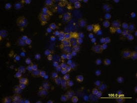 CD55/DAF antibody in Human PBMCs by Immunocytochemistry (ICC).