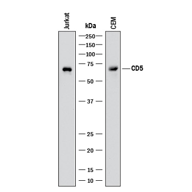Detection of Human CD5 antibody by Western Blot.