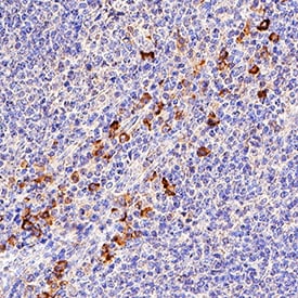 CD5 antibody in Human Tonsil by Immunocytochemistry (ICC).