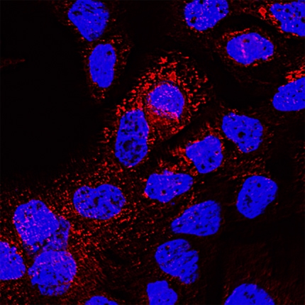 CD63 antibody in A431 Human Cell Line by Immunocytochemistry (ICC).
