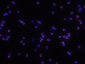 CD69 antibody in Mouse Splenocytes by Immunocytochemistry (ICC).