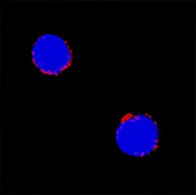 CD72 antibody in Mouse Splenocytes by Immunocytochemistry (ICC).