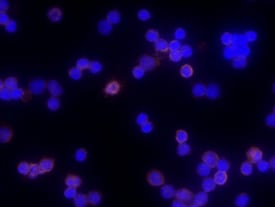 CD83 antibody in Mouse Splenocytes by Immunocytochemistry (ICC).