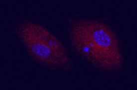 CD83 antibody in Mouse Dendritic Cells by Immunocytochemistry (ICC).