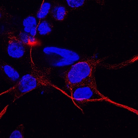CD83 antibody in THP-1 Human Cell Line by Immunocytochemistry (ICC).