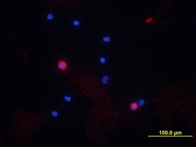 CD8a antibody in Feline PBMCs by Immunocytochemistry (ICC).