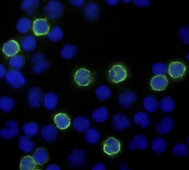 CD8a antibody in Human PBMCs by Immunocytochemistry (ICC).