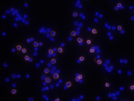 CD8a antibody in Mouse Splenocytes by Immunocytochemistry (ICC).