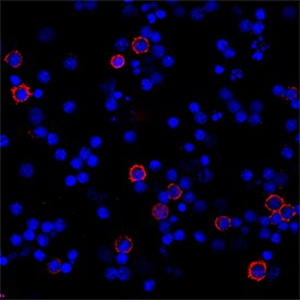 CD8a antibody in Human PBMCs by Immunocytochemistry (ICC).
