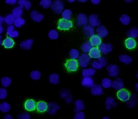 CD8a antibody in Human PBMCs by Immunocytochemistry (ICC).