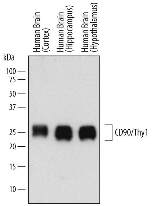 Detection of Human CD90/Thy1 antibody by Western Blot.