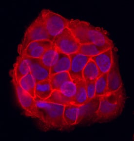 CD99 antibody in HepG2 Human Cell Line by Immunocytochemistry (ICC).