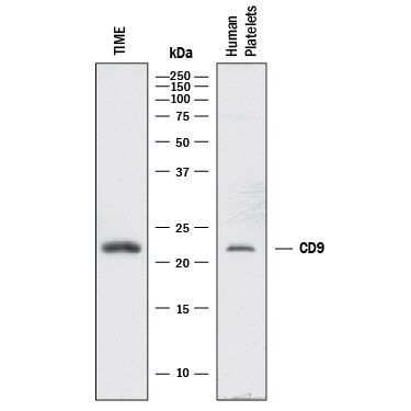 Detection of Human CD9 antibody by Western Blot.
