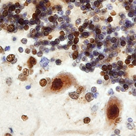 CDK5 Activator 1 antibody in Human Brain by Immunohistochemistry (IHC-P).