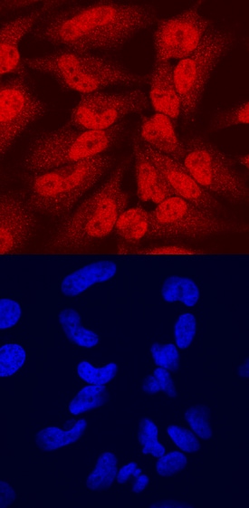 CEBP e antibody in HeLa Human Cell Line by Immunocytochemistry (ICC).