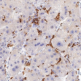 CETP antibody in Human Liver by Immunohistochemistry (IHC-P).