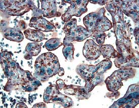 CFTR antibody in Human Placenta by Immunohistochemistry (IHC-P).