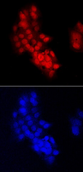CHD7 antibody in HepG2 Human Cell Line by Immunocytochemistry (ICC).