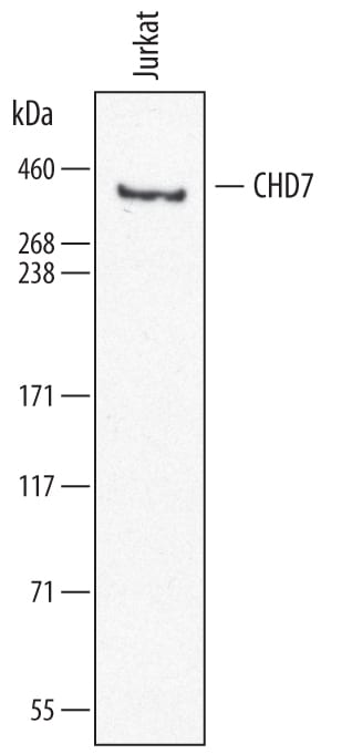 Detection of Human CHD7 antibody by Western Blot.