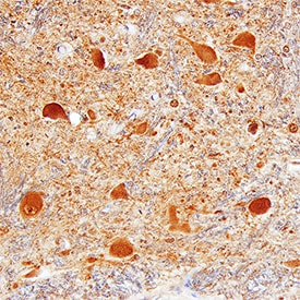 CHMP2B antibody in Human Brain by Immunohistochemistry (IHC-P).