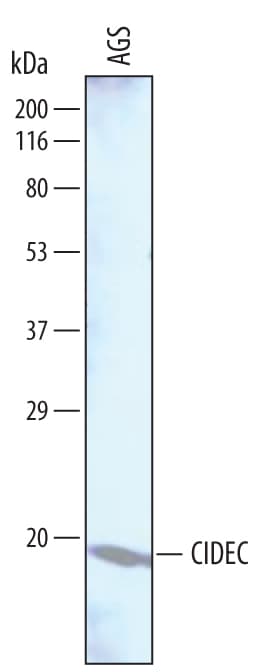 Detection of Human CIDEC antibody by Western Blot.