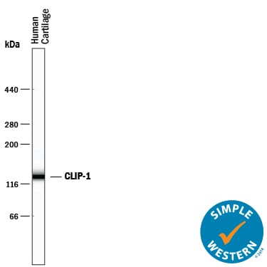 Detection of Human CILP‑1 antibody by Simple WesternTM.