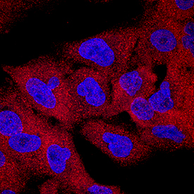 CIN85/SH3KBP1 antibody in A549 Human Cell Line by Immunocytochemistry (ICC).