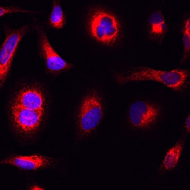 CKAP4/p63 antibody in HeLa Human Cell Line by Immunocytochemistry (ICC).