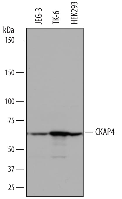 Detection of Human CKAP4/p63 antibody by Western Blot.