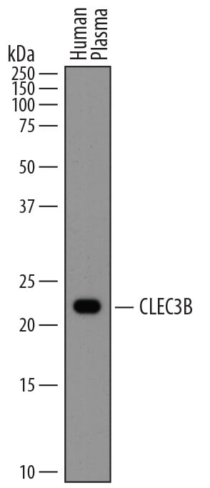 Detection of Human CLEC3B/Tetranectin antibody by Western Blot.