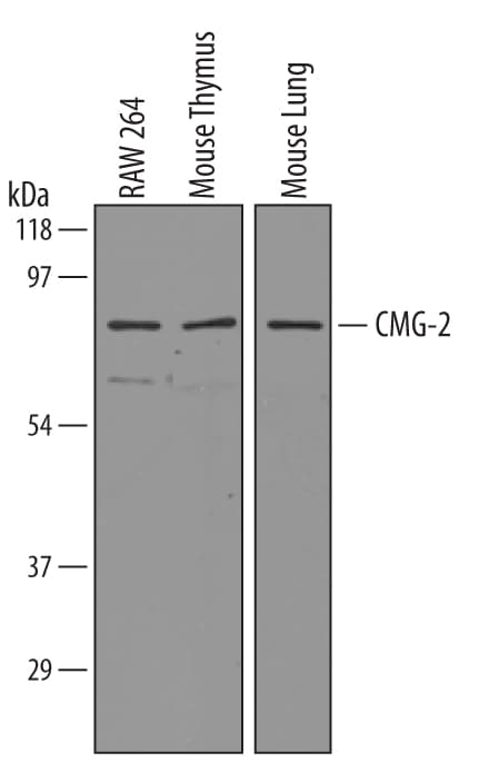 Detection of Mouse CMG‑2/ANTXR2 antibody by Western Blot.