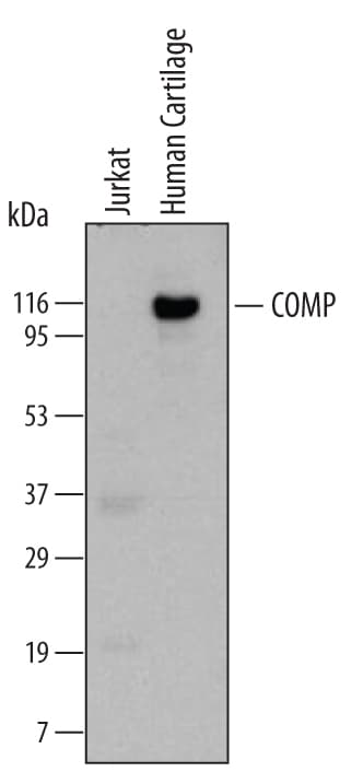 Detection of Human COMP/Thrombospondin‑5 antibody by Western Blot.
