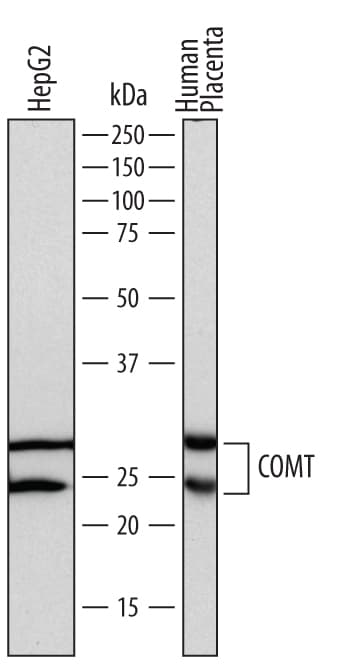 Detection of Human COMT antibody by Western Blot.