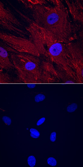 CTRP3/C1qTNF3/CORS26 antibody in Human Mesenchymal Stem Cells by Immunocytochemistry (ICC).