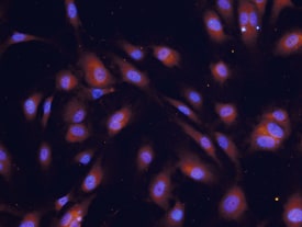COX‑2 antibody in HUVEC Human Cells by Immunocytochemistry (ICC).