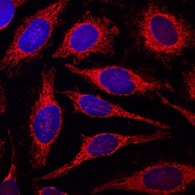 COX4 antibody in HeLa Human Cell Line by Immunocytochemistry (ICC).