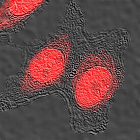 CREB antibody in MCF-7 Human Cell Line by Immunocytochemistry (ICC).