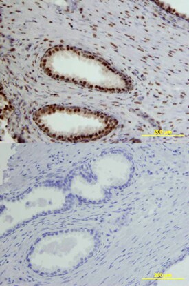 CREB antibody in Human Prostate by Immunohistochemistry (IHC-P).