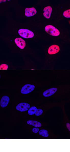 Phospho-CREB (S133) antibody in HeLa Human Cell Line by Immunocytochemistry (ICC).