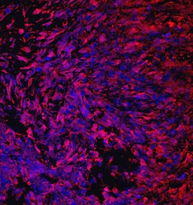 CRTAC1 antibody in Human Chondrocytes by Immunocytochemistry (ICC).