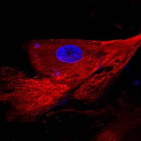 C-Reactive Protein/CRP antibody in BG01V Human Embryonic Stem Cells by Immunocytochemistry (ICC).