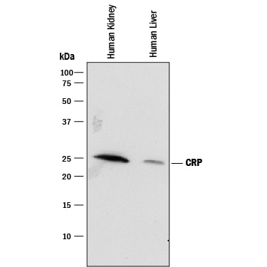 Detection of Human C-Reactive Protein/CRP antibody by Western Blot.