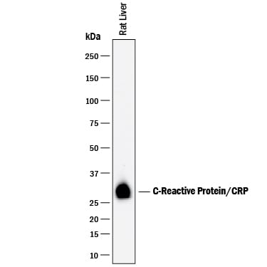 Detection of Rat C-Reactive Protein/CRP antibody by Western Blot.