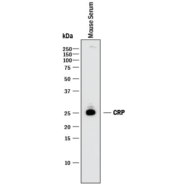 Detection of Mouse C-Reactive Protein/CRP antibody by Western Blot.