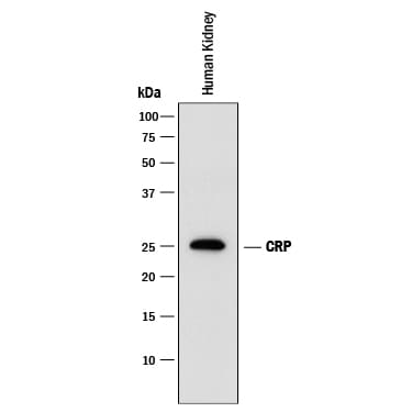 Detection of Human C-Reactive Protein/CRP antibody by Western Blot.